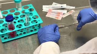 Cell harvesting