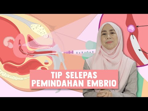 Tip Selepas Pemindahan Embrio