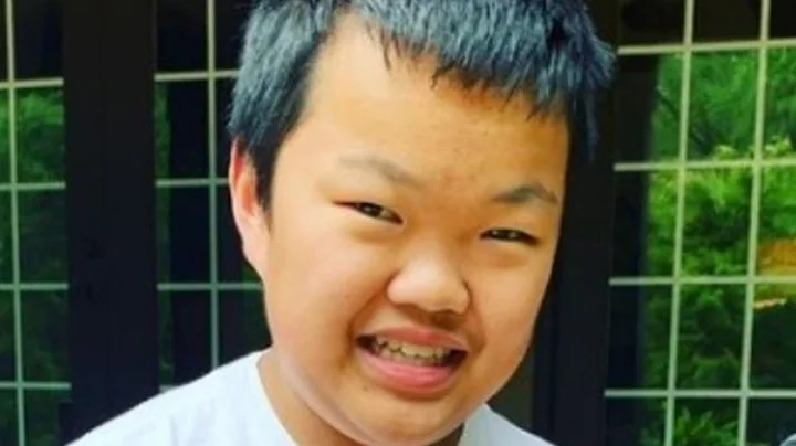 The Truth About Alex From 7 Little Johnstons