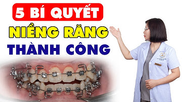 Trước Khi Cân Nhắc Niềng Răng Các Bạn Cần Xem Hết Video Này Từ Bác Sĩ Nhé | Bác sĩ Thu Gia Lâm