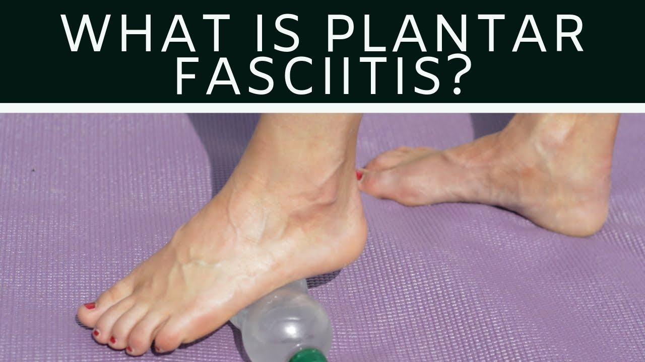 What Is Plantar Fasciitis YouTube