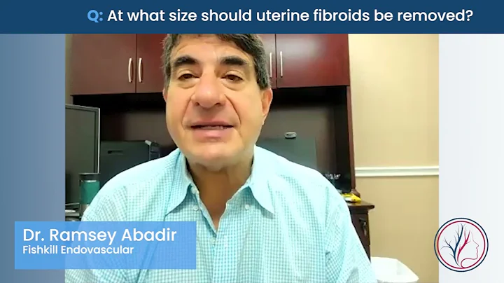 At what size should uterine fibroids be removed?