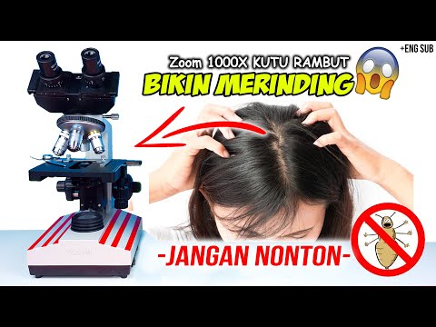 Video: Gambar Head Lice: Seperti Apa Kutu Itu?