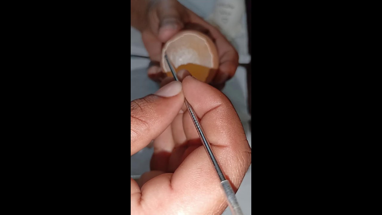 Raw Egg Peeling LIVE 🥚 | Can It Survive | Part 1