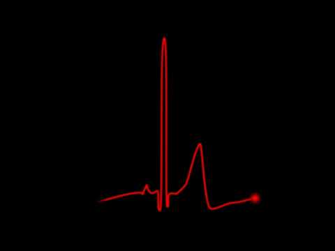 Heart Heartbeat Slow Heart Cardiology Bea Footage Stock Hd تخطيط نبضات القلب للمونتاج 