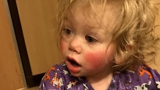 Meet 1YearOld Who’s Allergic to Tears