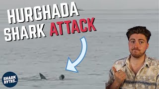 Hurghada Shark Attack: Shark Scientist Opinion.