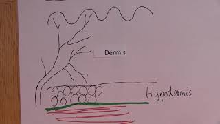 Burns 4, Classification of burns