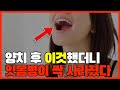 양치 후 이것했더니 잇몸 부기가 가라앉고 잇몸 질환이 싹 사라졌다