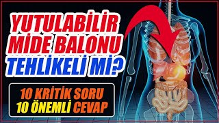 Yutulabilir mide balonu nedir? Yutulabilir mide balonu kimler kullanabilir?