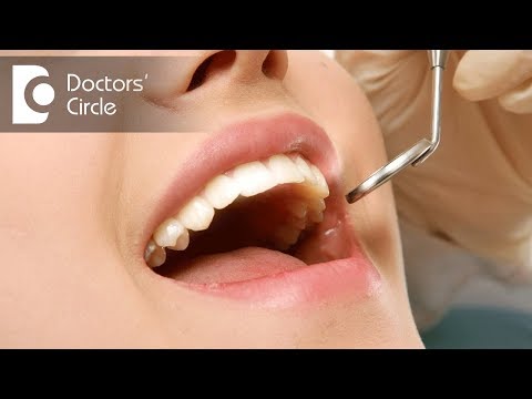 Does scaling of teeth make teeth weak? - Dr. Manesh Chandra Sharma