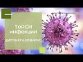 ToRCH-инфекции / ЦИТОМЕГАЛОВИРУС