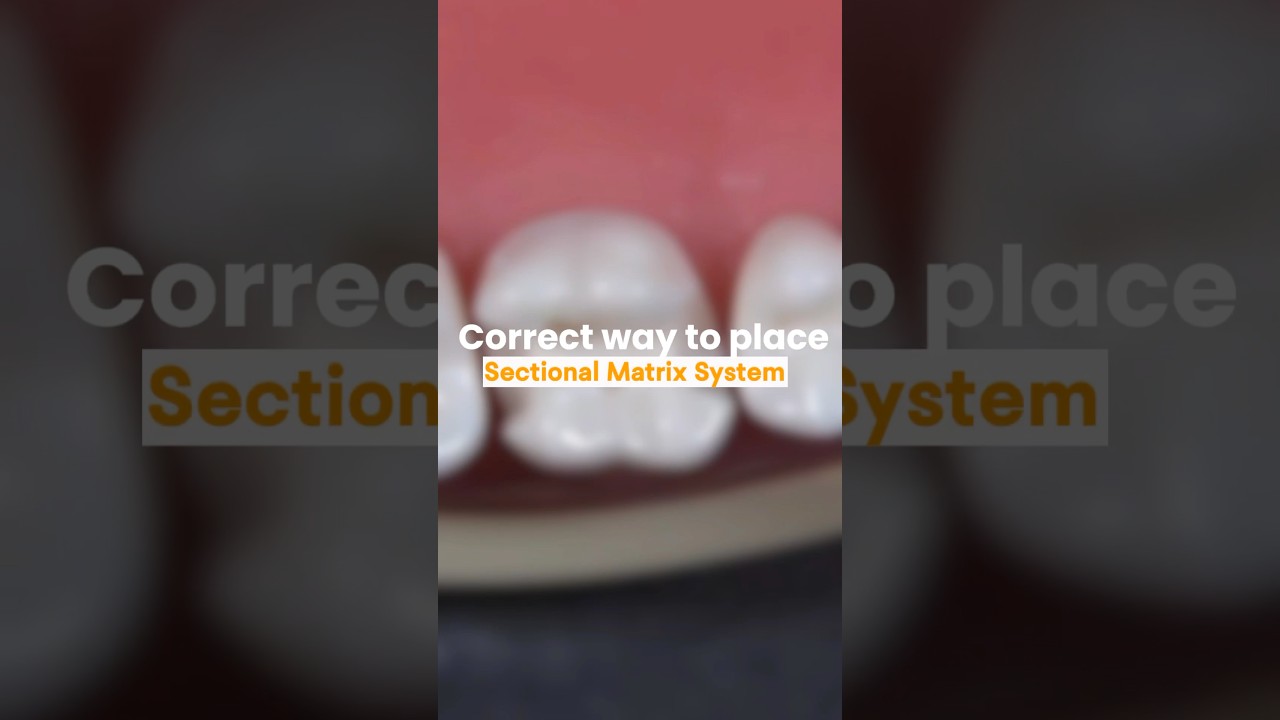 Correct way to place sectional matrix system.