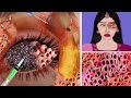 Asmr treatment animation from infected eye  2d animation restasmr1