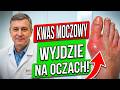 Kto by pomyślał, że dna moczanowa boi się zwykłej... Jeden produkt — i ataki ustępują