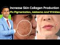 Wrinkle free Beautiful Younger Skin | How To boost Your Collagen Naturally