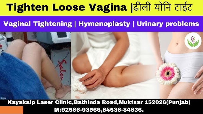 Basmanny Lane fohishalari