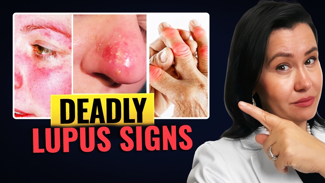 11 СМЕРТЕЛЬНЫХ признаков волчанки, которые нельзя игнорировать