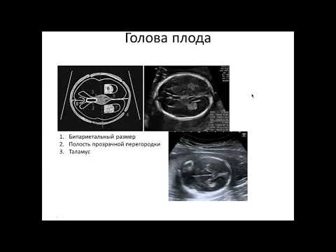 Видео: Точность, надежность и масштабируемость методов уменьшения размерности для одноклеточного анализа RNA-seq