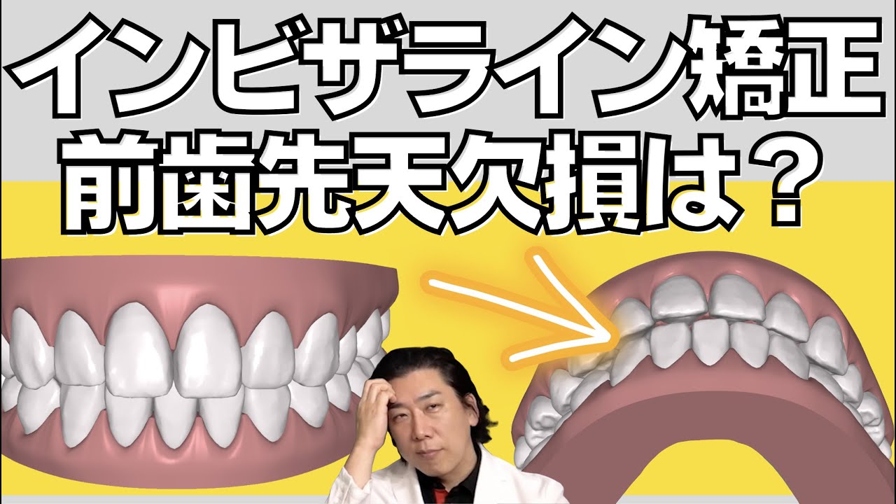 ブルマイスター　長歯　101mm 右前脚欠損 Yahoo!オークション -「ブルマイスターツヤクワガタ」(幼虫