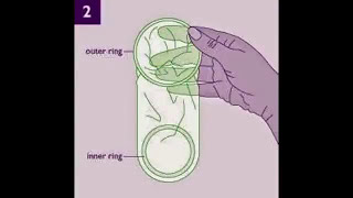 Cara Cara Memasang Kondom Wanita