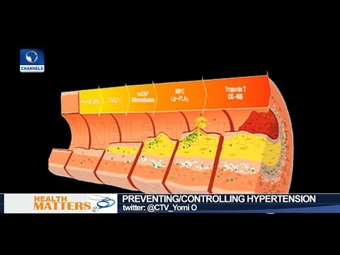Video: Wie kan hypertensie worden voorkomen?