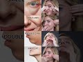 Basic Face fitness