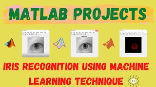 IRIS RECOGNITION USING MACHINE LEARNING TECHNIQUE | Artificial Neural Network Projects