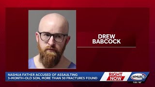 3-month-old New Hampshire boy suffers more than 30 fractures; father faces felony charges