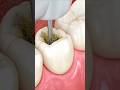 दांत के दर्द और इंफेक्शन में असरदार 5 दवाइयाँ | Tooth Pain &amp; Infection Treatment | Dental Care Tips