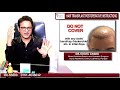 After Hair Transplant Instructions and Care - Dr. Vikas Gawri