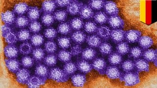 Norovirus animation: How cold plasma can kill virus that causes food poisoning