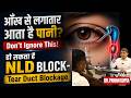 जब सफेद पानी आने लगा तो हुई चिंता- पेशेंट/ Dr. Pawan Gupta