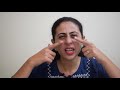 EXERCISE WITH ME FOR CHRONIC BELL'S PALSY