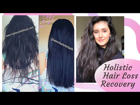 Recovered My Hair Loss + Why I Lost It + What I Took