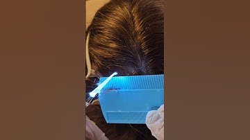 ASMR found lice, scalp check, roleplay