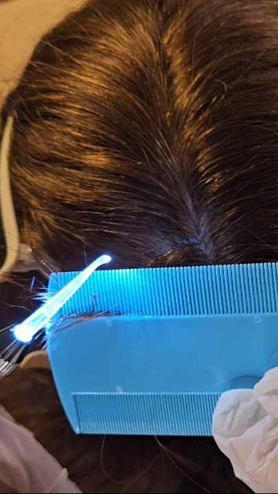 ASMR found lice, scalp check, roleplay