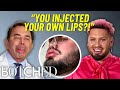 REJECTED By Botched: Stefan Has Been Injecting His OWN Lips?! | Botched | E!