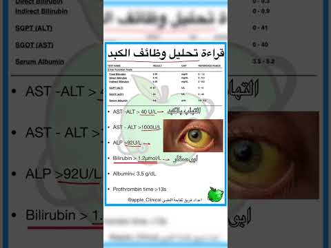 تحليل وظائف الكبد