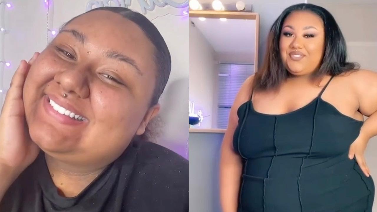 Teenager Weighing 24st Wants Weight Loss Surgery