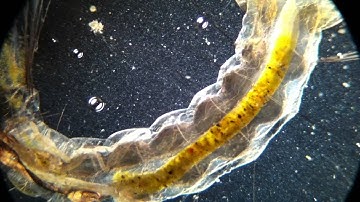 Dark field and Bright field