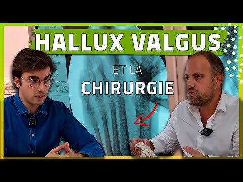 Hallux Valgus Surgery: This Surgeon Tells Us EVERYTHING
