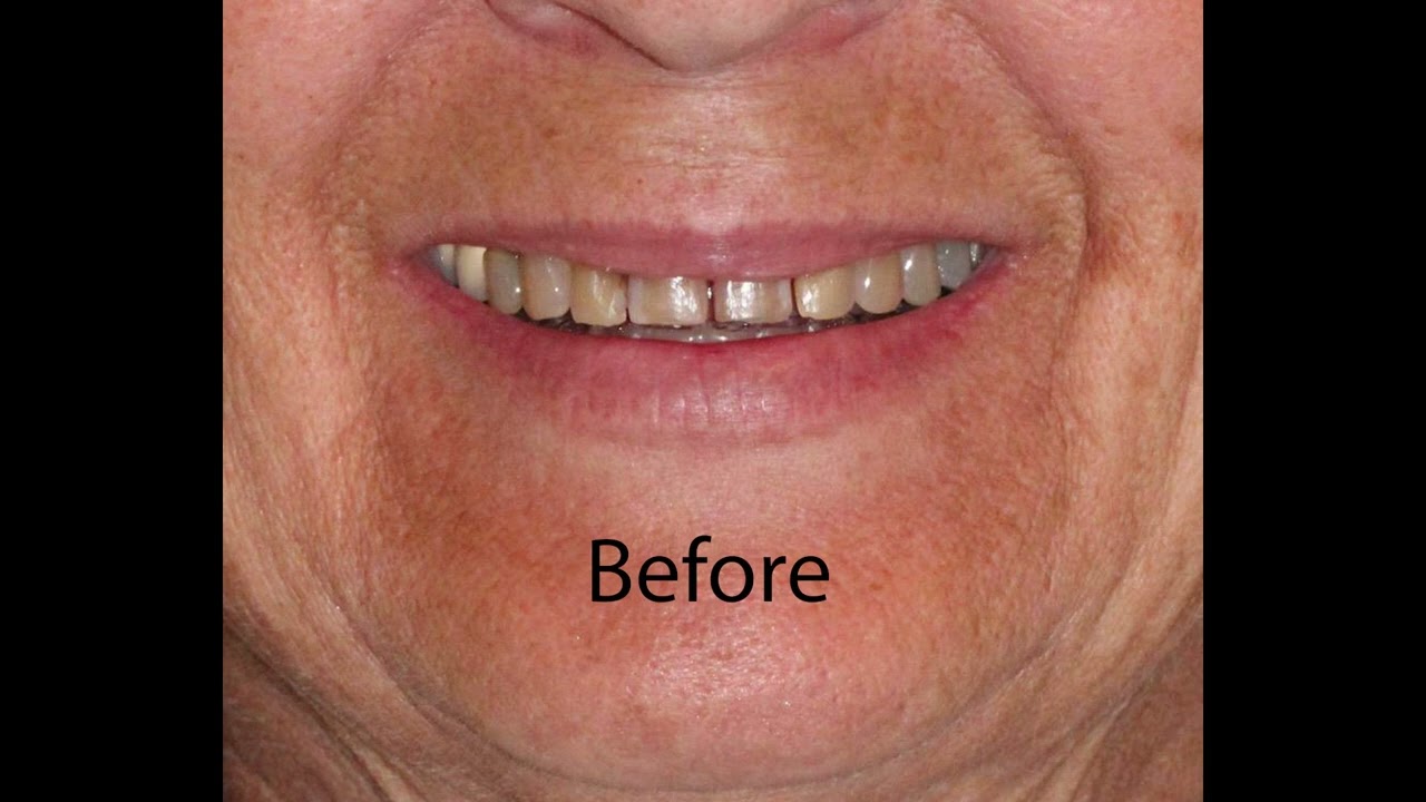 Before and After Dr. Shaw 08162023