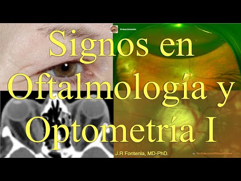 Signos en Oftalmología y Optometría, Parte I. - YouTube