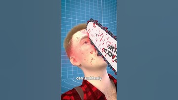 Thumbnail of how does chainsaw KICKBACK work?