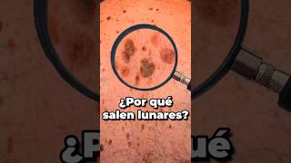 ¿Por qué aparecen los lunares? 🤔🌟