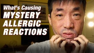 Mystery Allergic Reactions but don’t know why? 4 Tips to find Allergic Triggers | Ep.233 by Jeffrey Lin 4,813 views 4 years ago 21 minutes