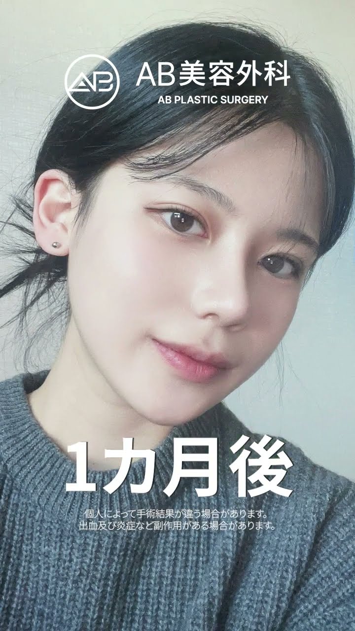整形マジック: 輪郭+鼻で完璧な美しさに変身！ #韓国整形 #整形ビフォーアフター #おすすめ