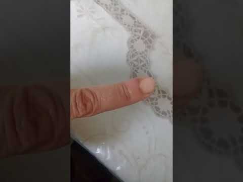 علاج ورم الاصبع بالبصل بعد 3 ساعات