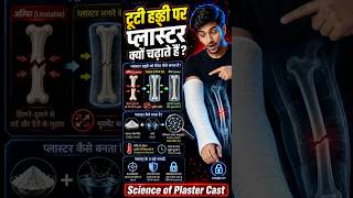 टूटी हड्डी पर प्लास्टर क्यों चढ़ाया जाता है? | Science of Plaster Cast